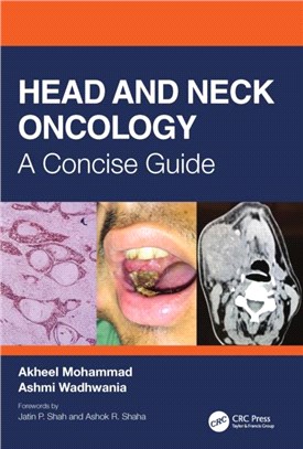 Head and Neck Oncology：A Concise Guide