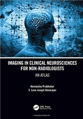 Imaging in Clinical Neurosciences for Non-radiologists：An Atlas