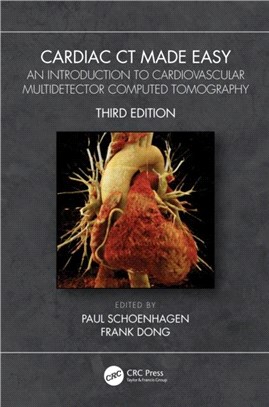 Cardiac CT Made Easy：An Introduction to Cardiovascular Multidetector Computed Tomography