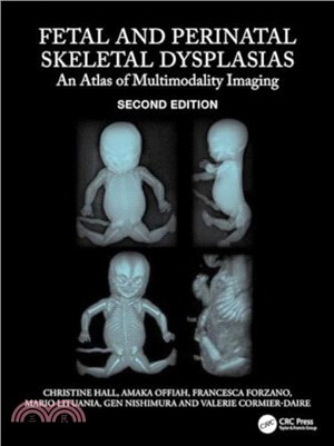 Fetal and Perinatal Skeletal Dysplasias：An Atlas of Multimodality Imaging