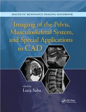 Imaging of the Pelvis, Musculoskeletal System, and Special Applications to CAD