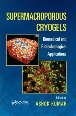 Supermacroporous Cryogels：Biomedical and Biotechnological Applications