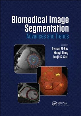 Biomedical Image Segmentation：Advances and Trends