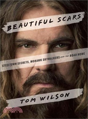 Beautiful Scars :Steeltown S...