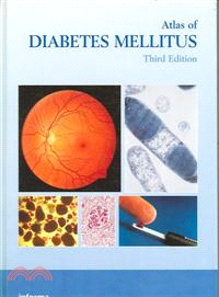 Atlas of Diabetes Mellitus