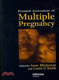 Prenatal Assessment of Multiple Pregnancy