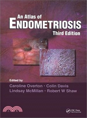 Atlas of Endometriosis