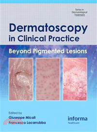 Dermatoscopy in Clinical Practice：Beyond Pigmented Lesions