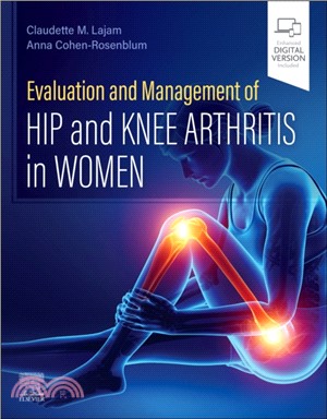Evaluation and Management of Hip and Knee Arthritis in Women