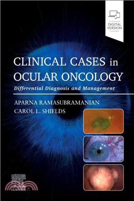 Clinical Cases in Ocular Oncology：Differential Diagnosis and Management