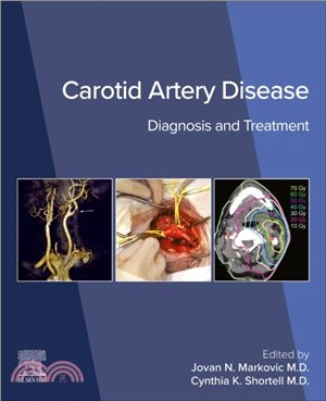 Carotid Artery Disease