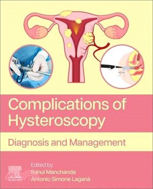 Complications of Hysteroscopy: Diagnosis and Management