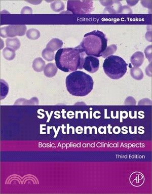 Systemic Lupus Erythematosus: Basic, Applied and Clinical Aspects