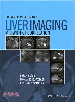 Liver imagingMRI with CT cor...