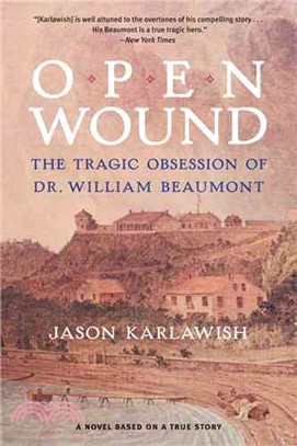 Open Wound ― The Tragic Obsession of Dr. William Beaumont