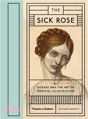 The Sick Rose ― Disease and the Art of Medical Illustration