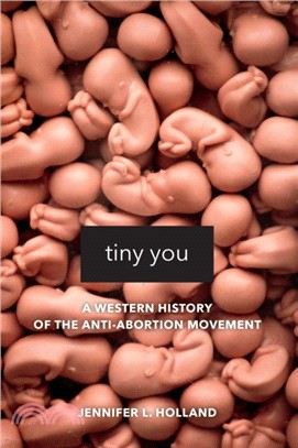 Tiny You：A Western History of the Anti-Abortion Movement