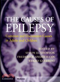 The Causes of Epilepsy ─ Common and Uncommon Causes in Adults and Children