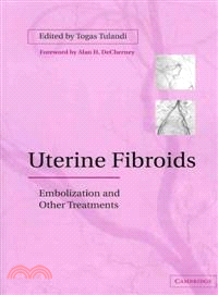 Uterine Fibroids:Embolization and other Treatments