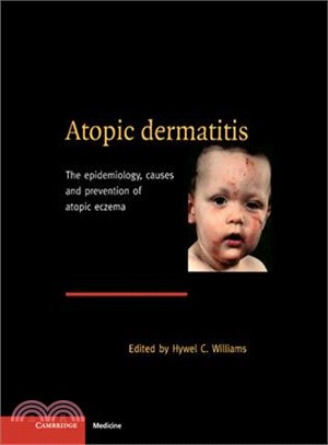 Atopic Dermatitis：The Epidemiology, Causes and Prevention of Atopic Eczema