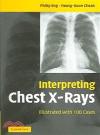 Interpreting Chest X-Rays：Illustrated with 100 Cases