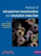 Manual of Intrauterine Insemination and Ovulation Induction