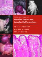 Color Atlas of Vascular Tumors and Vascular Malformations