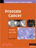 Prostate Cancer