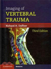 Imaging of Vertebral Trauma