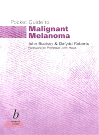 POCKET GUIDE TO MALIGNANT MELANOMA