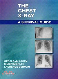 The Chest X-Ray