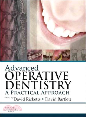 Advanced operative dentistry...