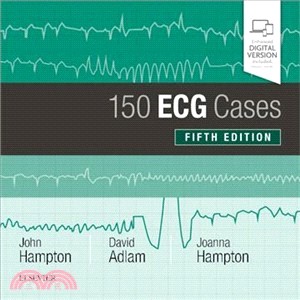 150 ECG Cases