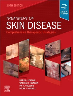 Treatment of Skin Disease：Comprehensive Therapeutic Strategies