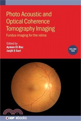 Photo Acoustic and Optical Coherence Tomography Imaging: Fundus Imaging for the Retina