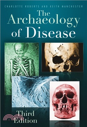 The Archaeology of Disease：Third Edition