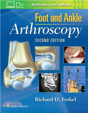 Foot and Ankle Arthroscopy