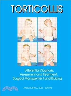 Torticollis ─ Differential Diagnosis, Assessment, and Treatment, Surgical Management and Bracing