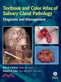 Textbook And Color Atlas Of Salivary Gland Pathology: Diagnosis And Management