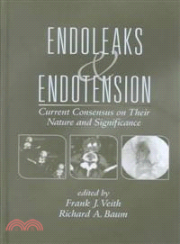 Endoleaks & Endotension ─ Current Consensus on Their Nature and Significance