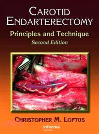 Carotid Endarterectomy：Principles and Technique