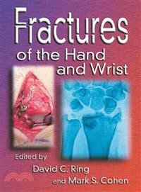 Fractures of the Hand and Wrist