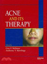 Acne And Its Therapy