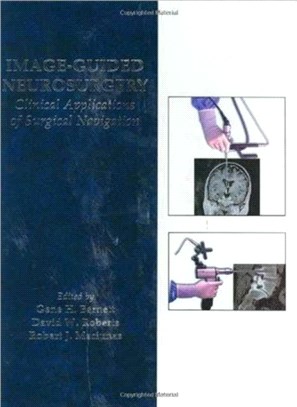 Image-Guided Neurosurgery