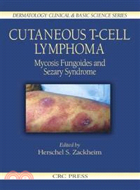 Cutaneous T-Cell Lymphoma：Mycosis Fungoides and Sezary Syndrome