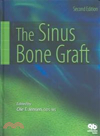 The Sinus Bone Graft