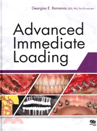 Advanced Immediate Loading