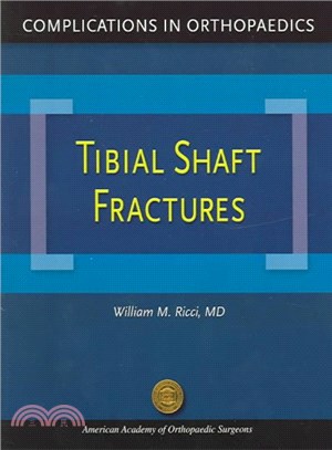 Tibial Shaft Fractures