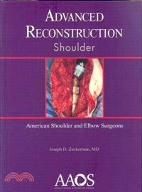 Advanced Reconstruction Shoulder