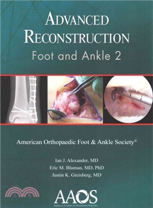 Advance Reconstruction ― Foot and Ankle 2